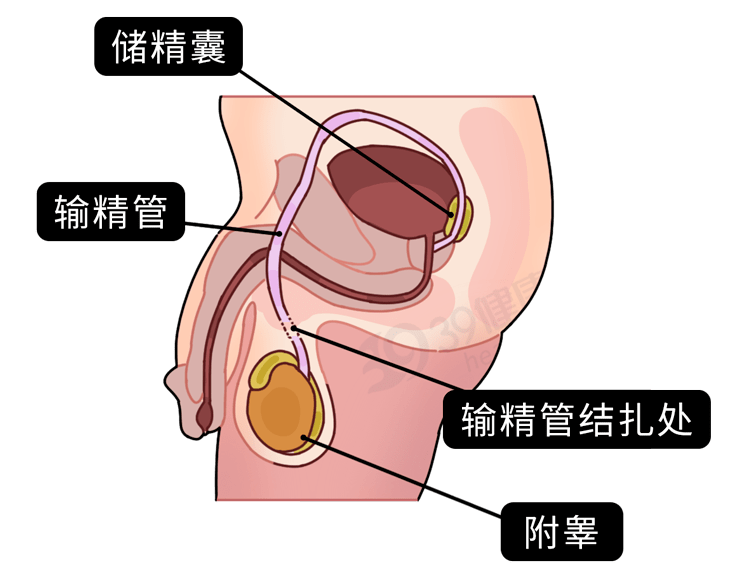 最新精子窝最新地址